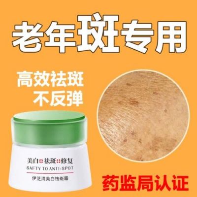 斑斑净价格（斑干净是正规产品吗）-图2