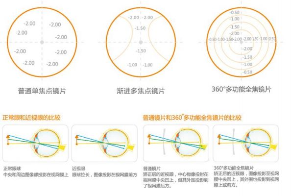 环焦镜价格（环焦镜片对眼睛好么）