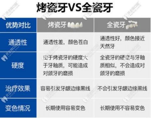 镍铬假牙价格（镶镍铬牙价格）