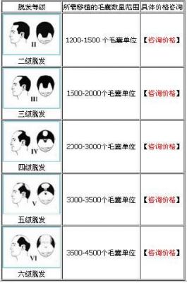 苏州植发价格的简单介绍