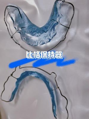 哈雷保持器价格（哈雷保持器价格一般是多少）